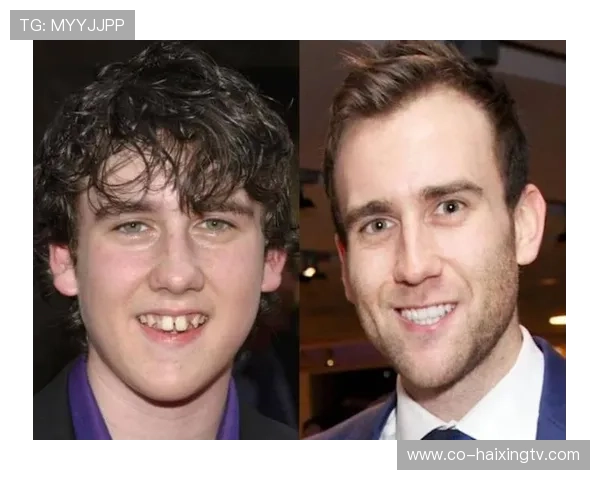 足球球星换牙事件揭秘 从牙齿到笑容的背后故事 足球球星换牙事件揭秘 从牙齿到笑容的背后故事